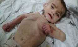مضايا‬ تموت من الجوع