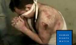 هيومن رايتس: 20 أسلوب تعذيب موثقا في معتقلات سوريا