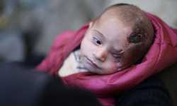 هكذا تم إنقاذ الرضيع كريم الذي اغتال النظام السوري عينه وأمه (شهادات)