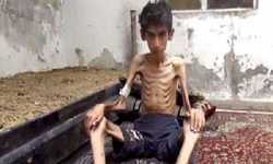 مضايا التي تموت جوعاً بصمت؟!