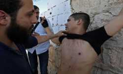  شهادات ناجين... أساليب التعذيب في سجون النظام السوري