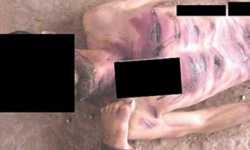 أفظع أسلوب للتعذيب في سجون النظام: تقطيع أجساد المعتقلين و حرقها بـ(آلة اللحام)